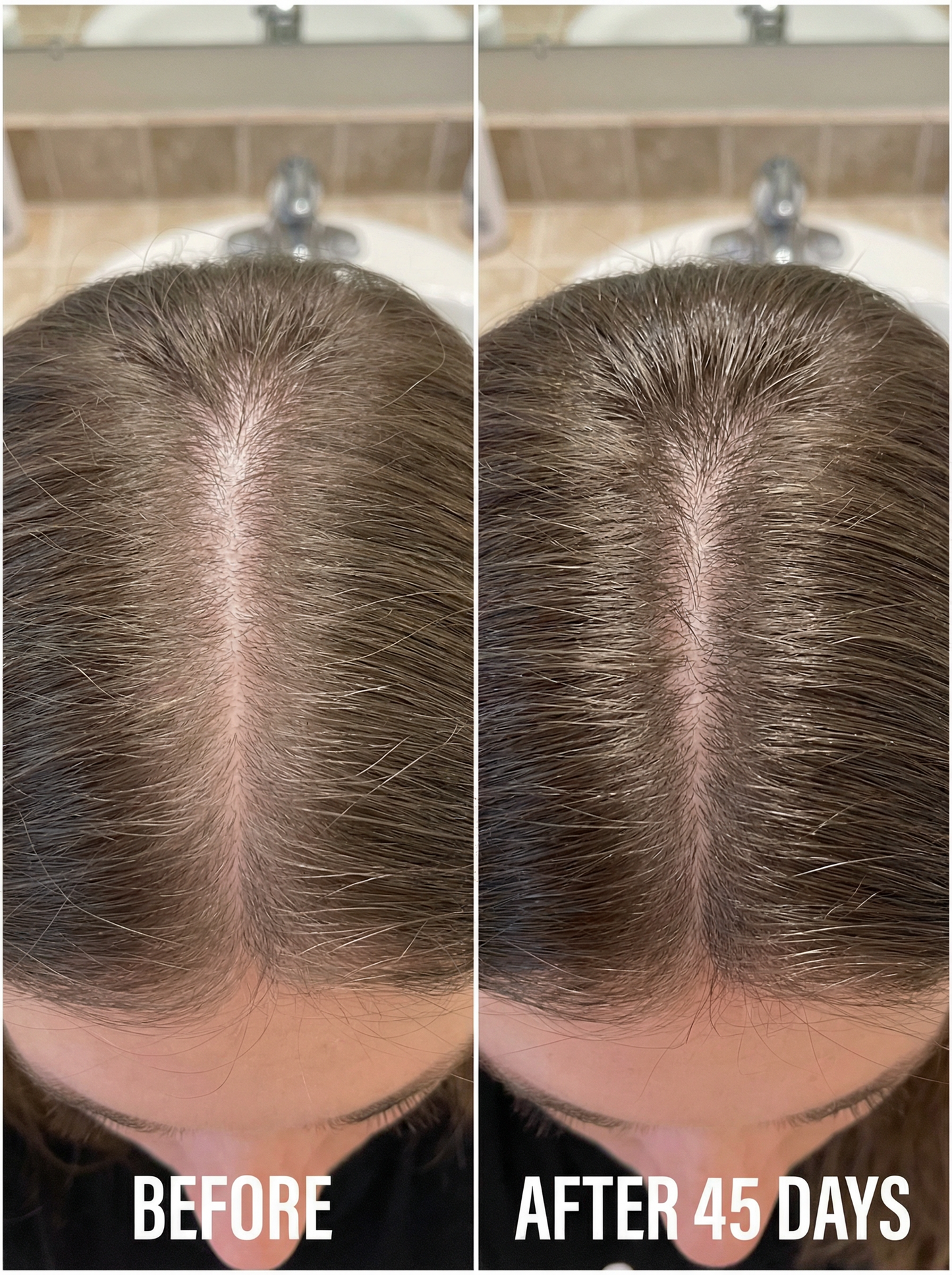 Élixir Densité & Pousse – Batana Sauvage + Romarin (Cure 1 Mois)