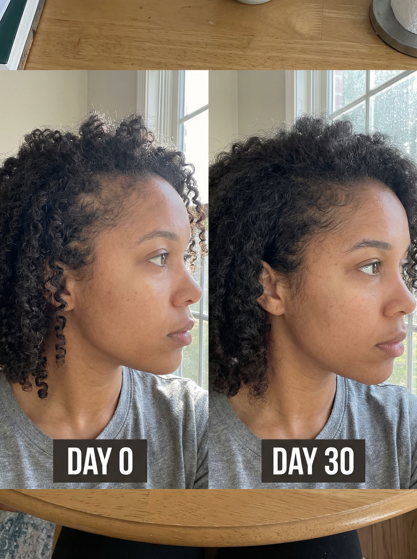 Élixir Densité & Pousse – Batana Sauvage + Romarin (Cure 1 Mois)