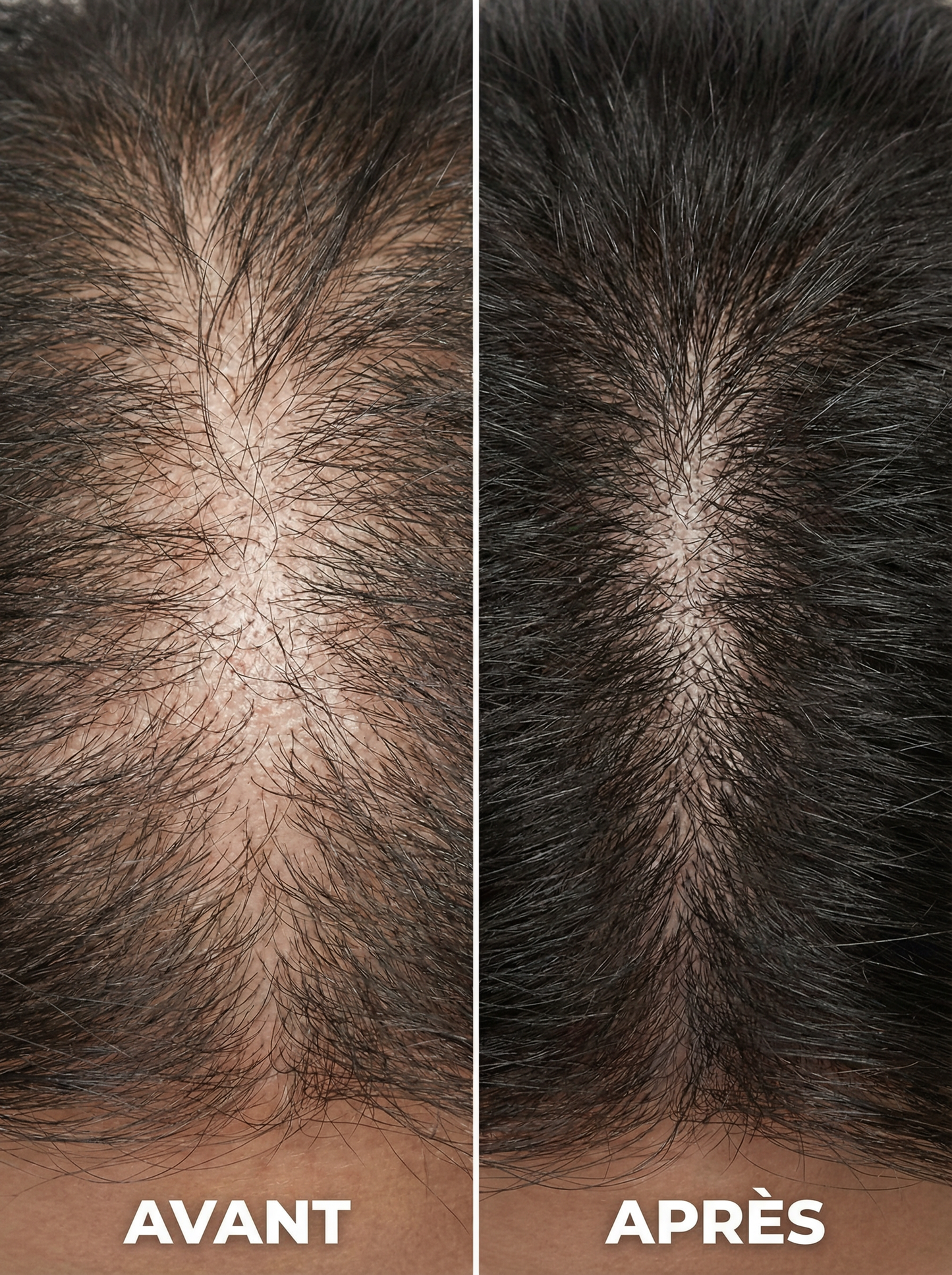 Élixir Densité & Pousse – Batana Sauvage + Romarin (Cure 1 Mois)