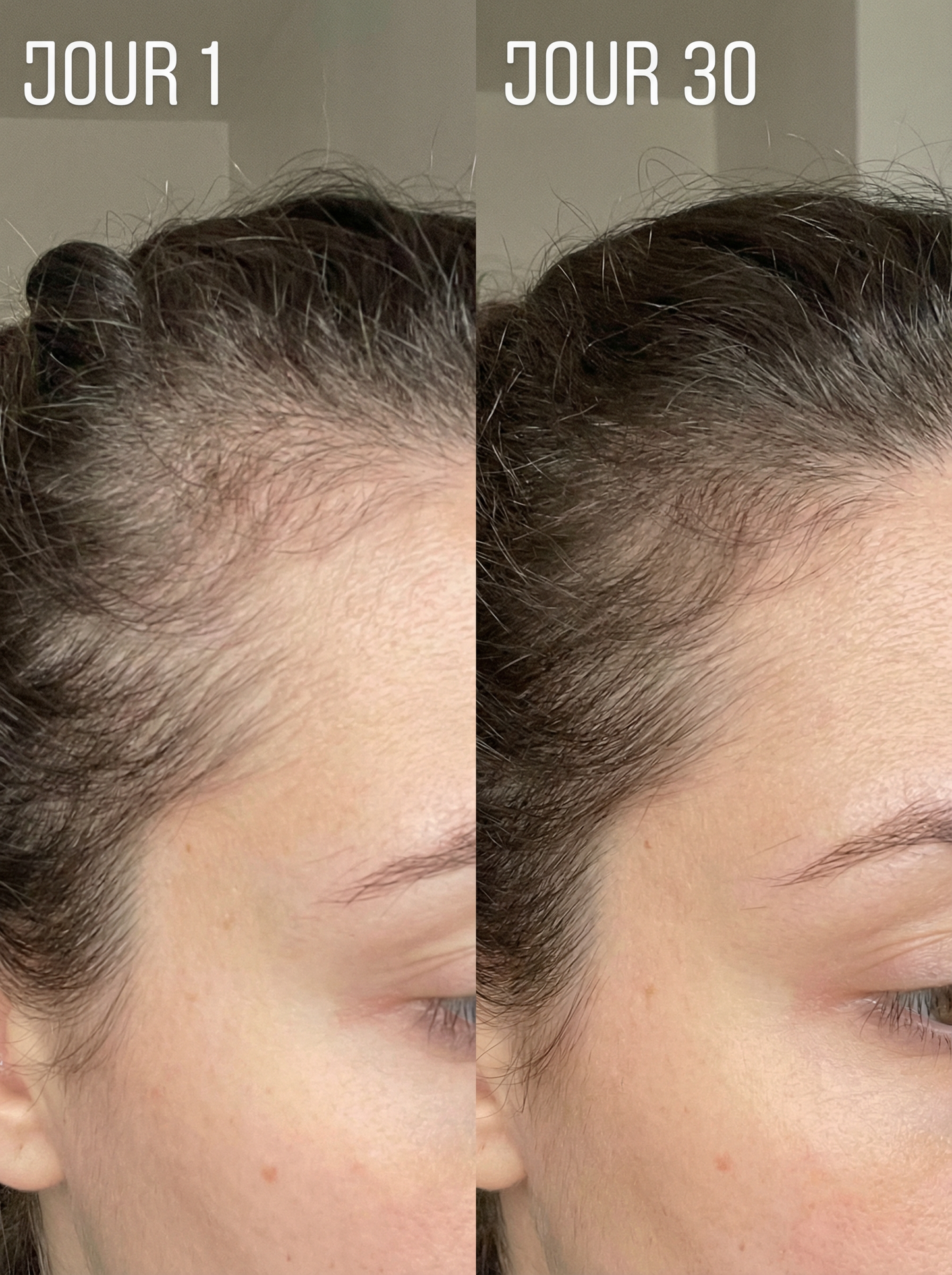 Élixir Densité & Pousse – Batana Sauvage + Romarin (Cure 1 Mois)